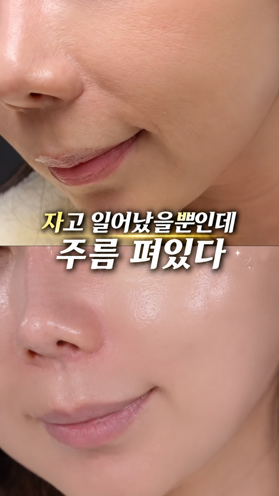 영롱한골드손패치 상세이미지