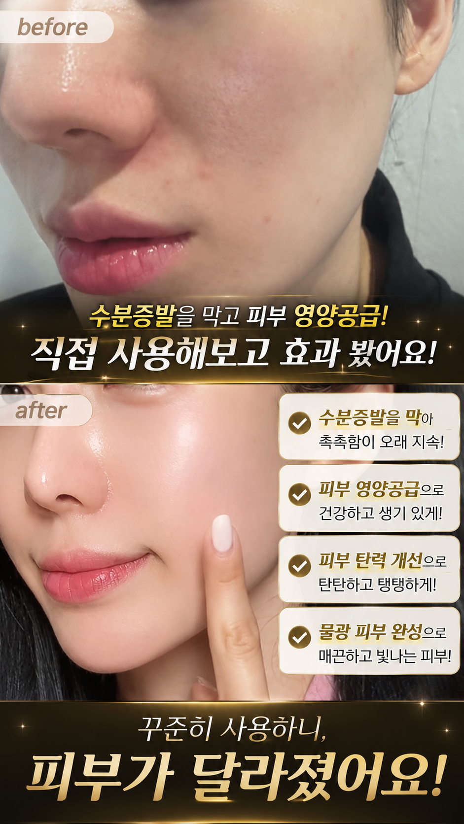 영롱한골드손패치 상세이미지
