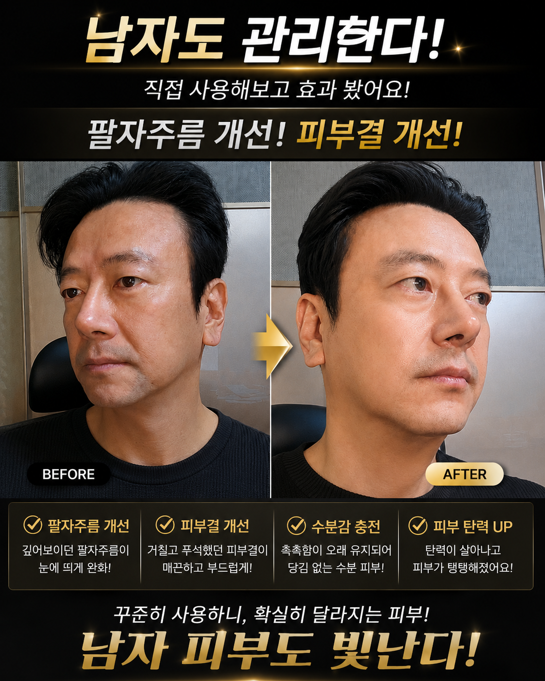 영롱한골드손패치 상세이미지