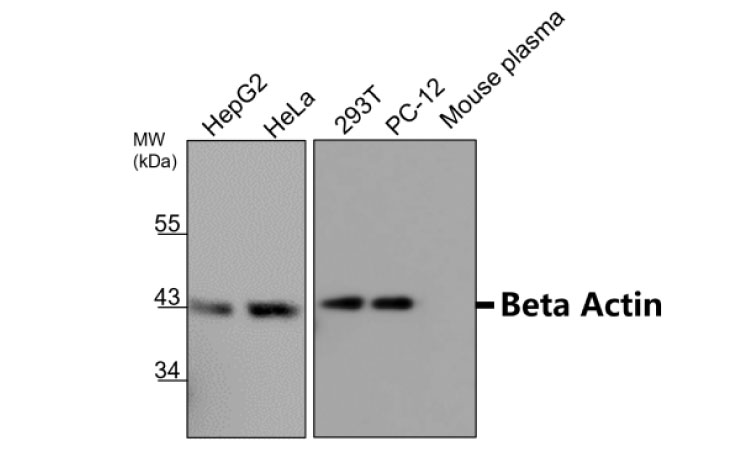 Beta Actin antibody