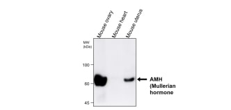 AMH (Mullerian hormone) antibody