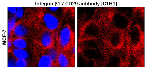Integrin β1 / CD29 antibody [C1H1]