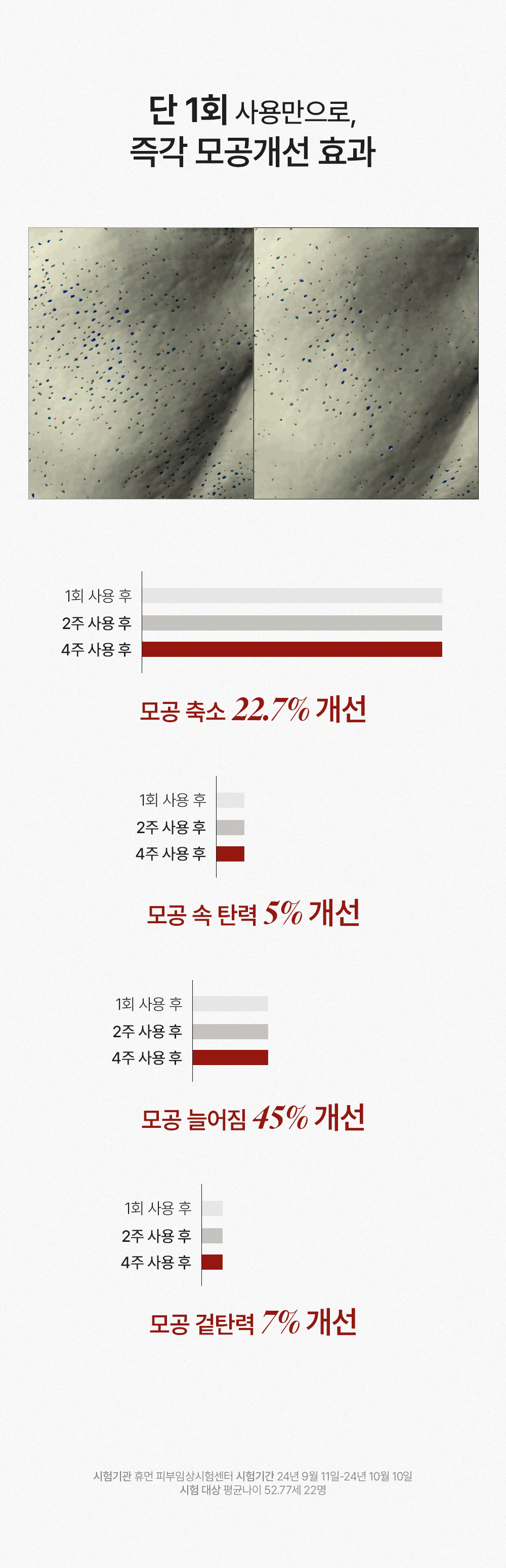 악세사리 -S105L24