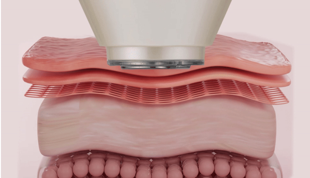 악세사리 -S29L24