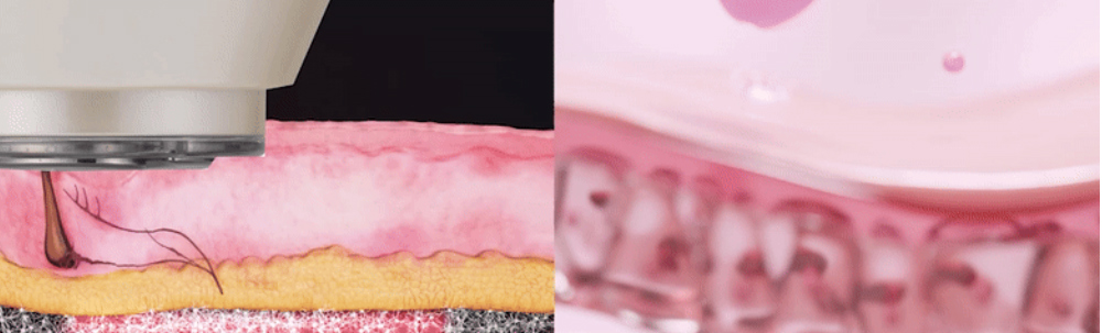 악세사리 -S29L13