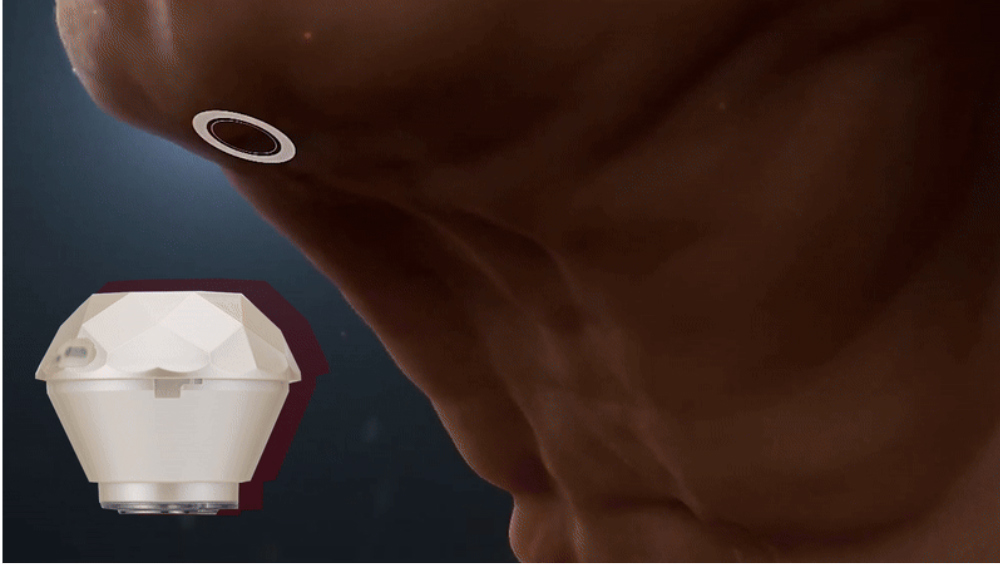 악세사리 -S29L29