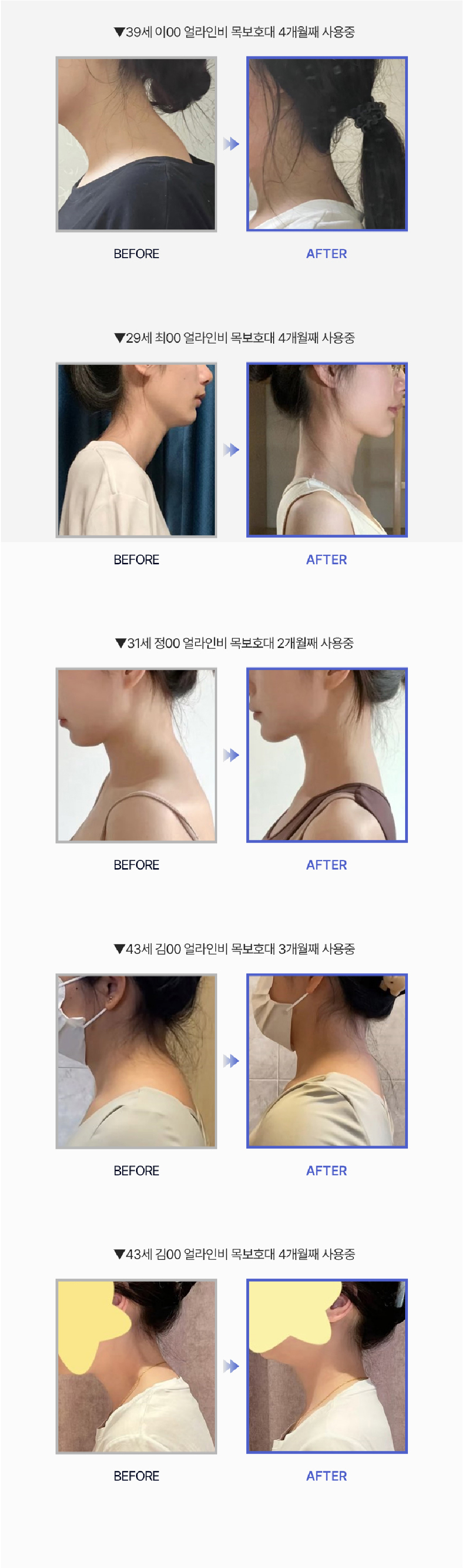 얼라인비 목보호대